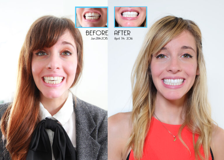 Patient Smile Transformations
