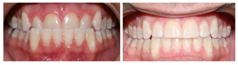 Adultmale-anterior_3_7_2024_5_01_53_PM