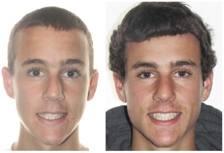 Patient Smile Transformations